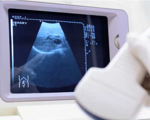 天津助孕价格，卵巢性不孕的常见检查项目有哪些？