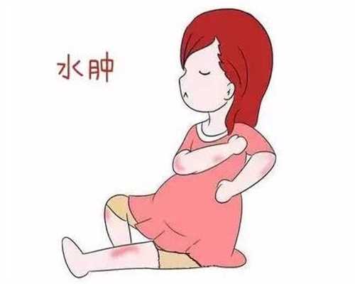 南京正规代怀孕保密咨询,如何改善母乳性黄疸