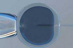 南京正规的供卵医院,接近母乳婴儿奶粉排行榜