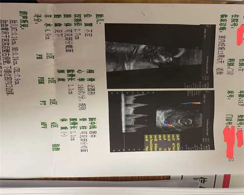 上海供卵机构排名生育问题不再是无解难题