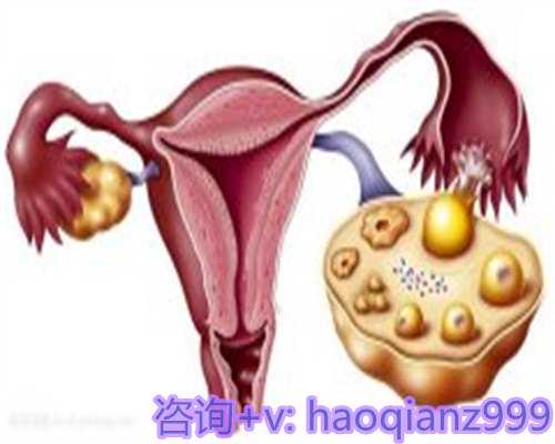 供卵咨询电话,沈阳助孕中介借卵