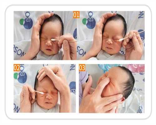 天津供卵代生价格，输卵管积水会影响胚胎着床吗？