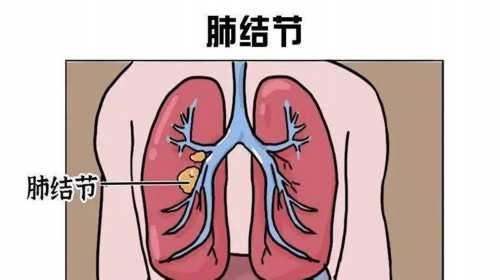 多囊卵巢综合症原因，女性朋友注意了