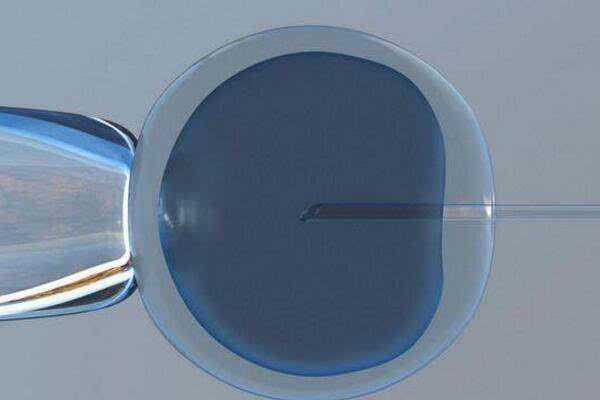 广东辅助代怀,辅助生殖纳入医保迈出“破冰”一步，代表委员：或许预示着将